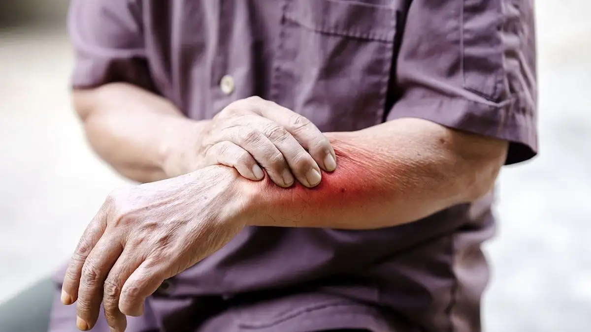 Skin Permeation Testing Services